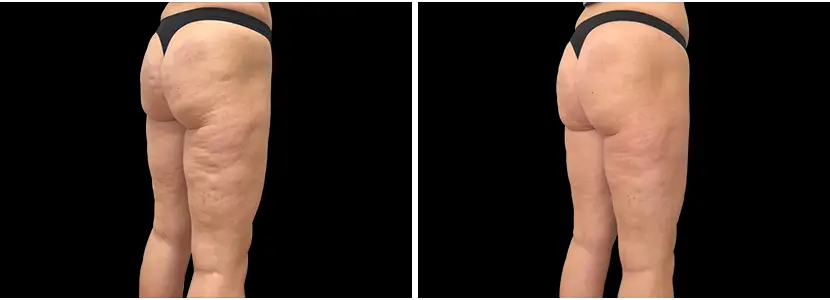 nalgas02